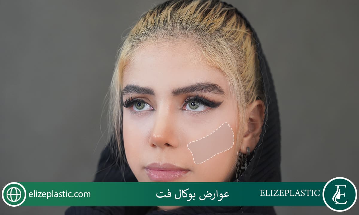  عوارض بوکال فت